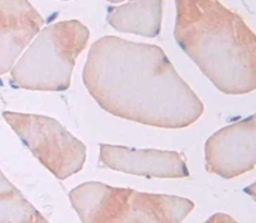 Polyclonal Antibody to Thrombospondin 1 (THBS1)