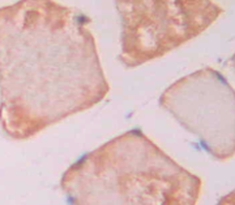 Polyclonal Antibody to Thrombospondin 1 (THBS1)