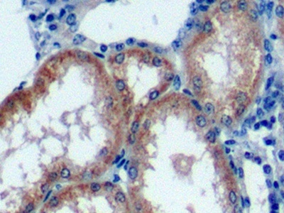 Polyclonal Antibody to Transcription Factor P65 (NFKB3)