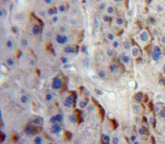 Polyclonal Antibody to A Disintegrin And Metalloprotease 8 (ADAM8)