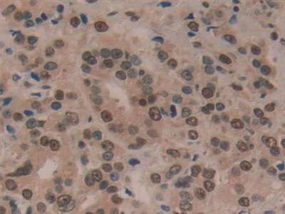 Polyclonal Antibody to Hepatoma Derived Growth Factor (HDGF)