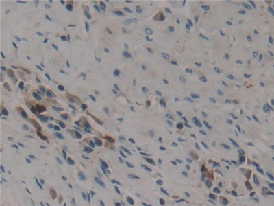 Polyclonal Antibody to Midkine (MK)