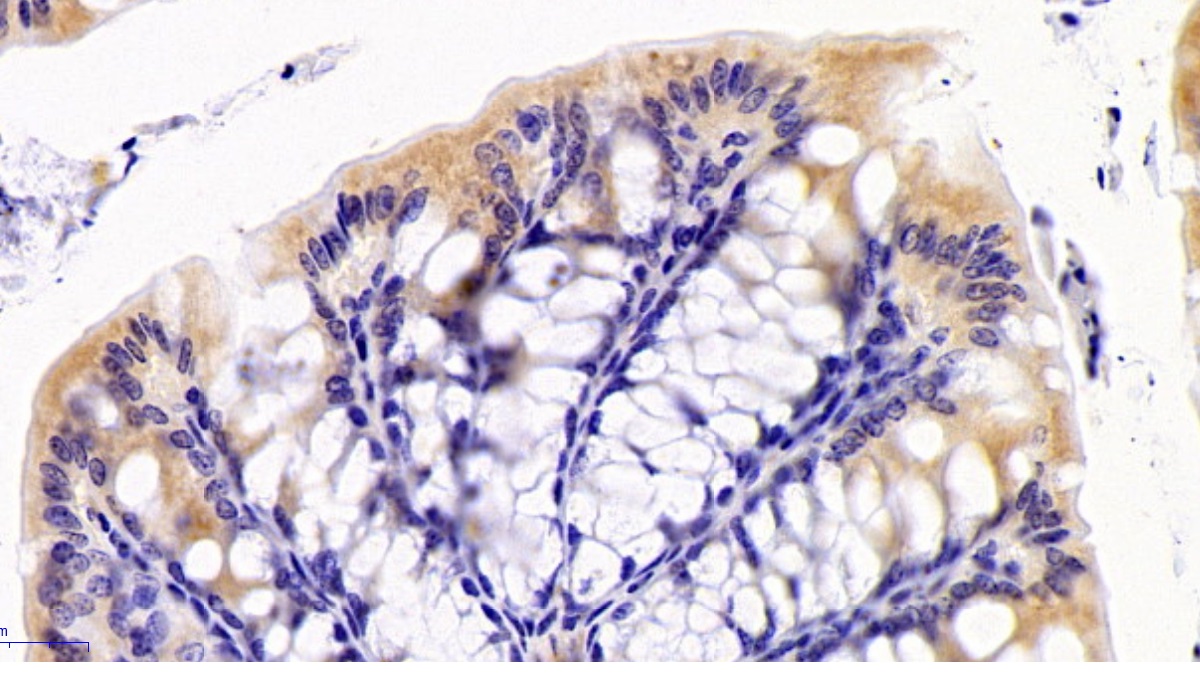 Polyclonal Antibody to Midkine (MK)