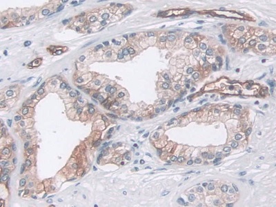 Polyclonal Antibody to Pepsin (PP)