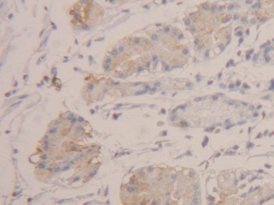 Polyclonal Antibody to Hexosaminidase B Beta (HEXb)