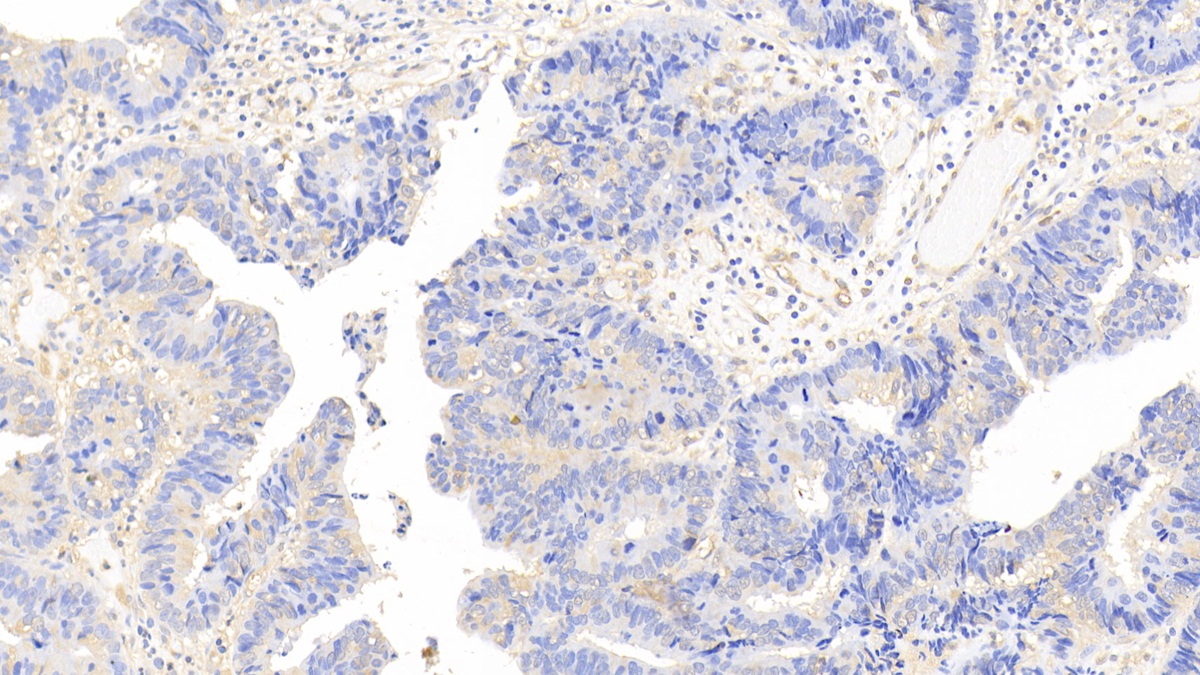 Polyclonal Antibody to Calmodulin (CAM)