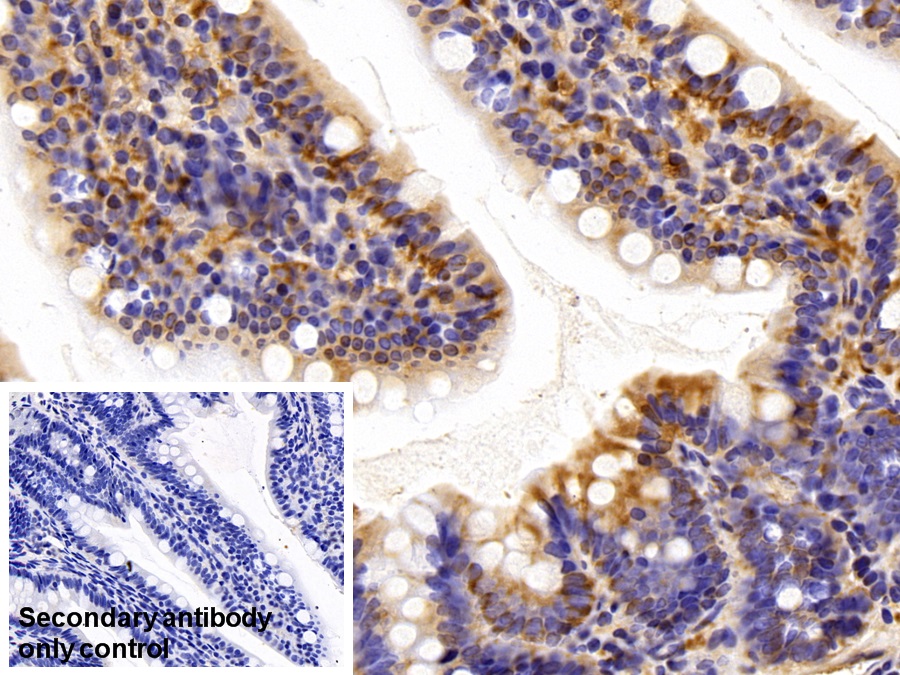 Polyclonal Antibody to Aldolase A, Fructose Bisphosphate (ALDOA)