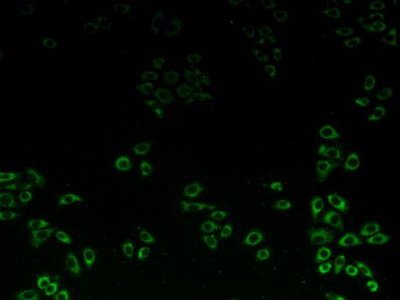 Polyclonal Antibody to Complement component 1 Q subcomponent-binding protein, mitochondrial (C1QBP)