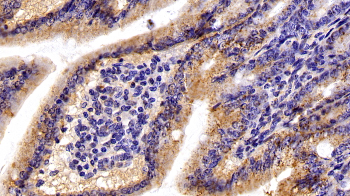 Polyclonal Antibody to Complement component 1 Q subcomponent-binding protein, mitochondrial (C1QBP)