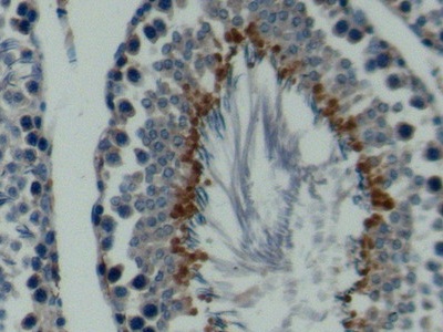 Polyclonal Antibody to Complement component 1 Q subcomponent-binding protein, mitochondrial (C1QBP)