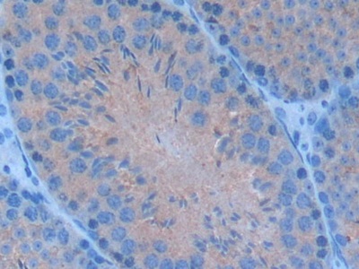 Polyclonal Antibody to Cluster Of Differentiation 28 (CD28)