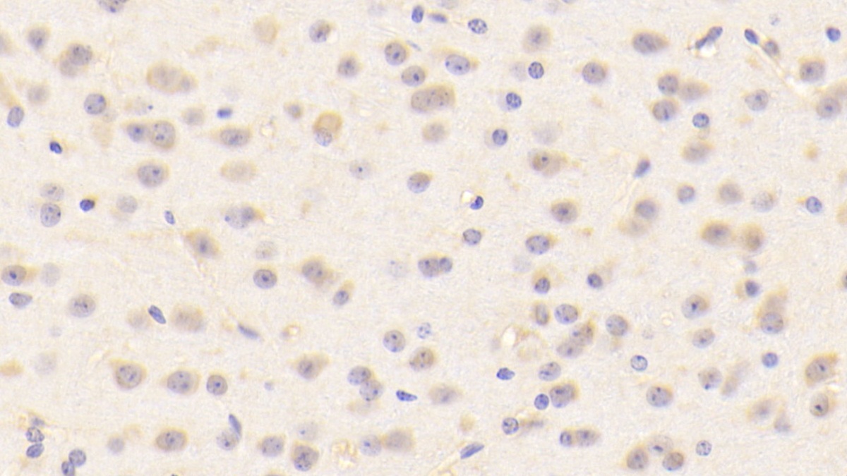 Polyclonal Antibody to Bone Morphogenetic Protein 1 (BMP1)