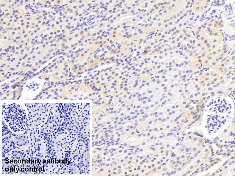 Polyclonal Antibody to Glutathione S Transferase Mu 2 (GSTM2)