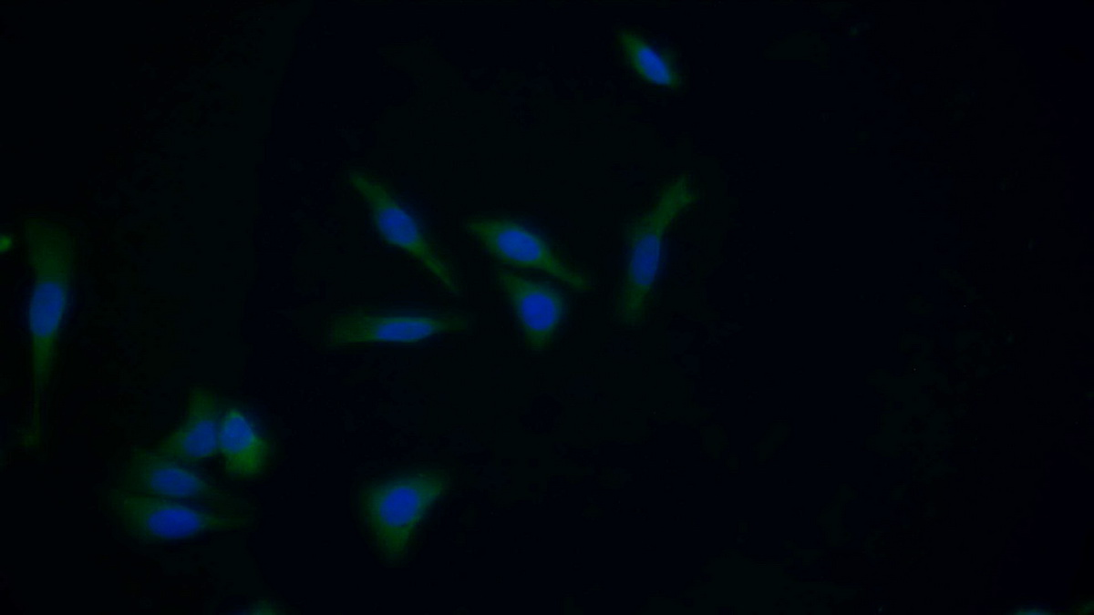 Polyclonal Antibody to Glutathione S Transferase Mu 1 (GSTM1)