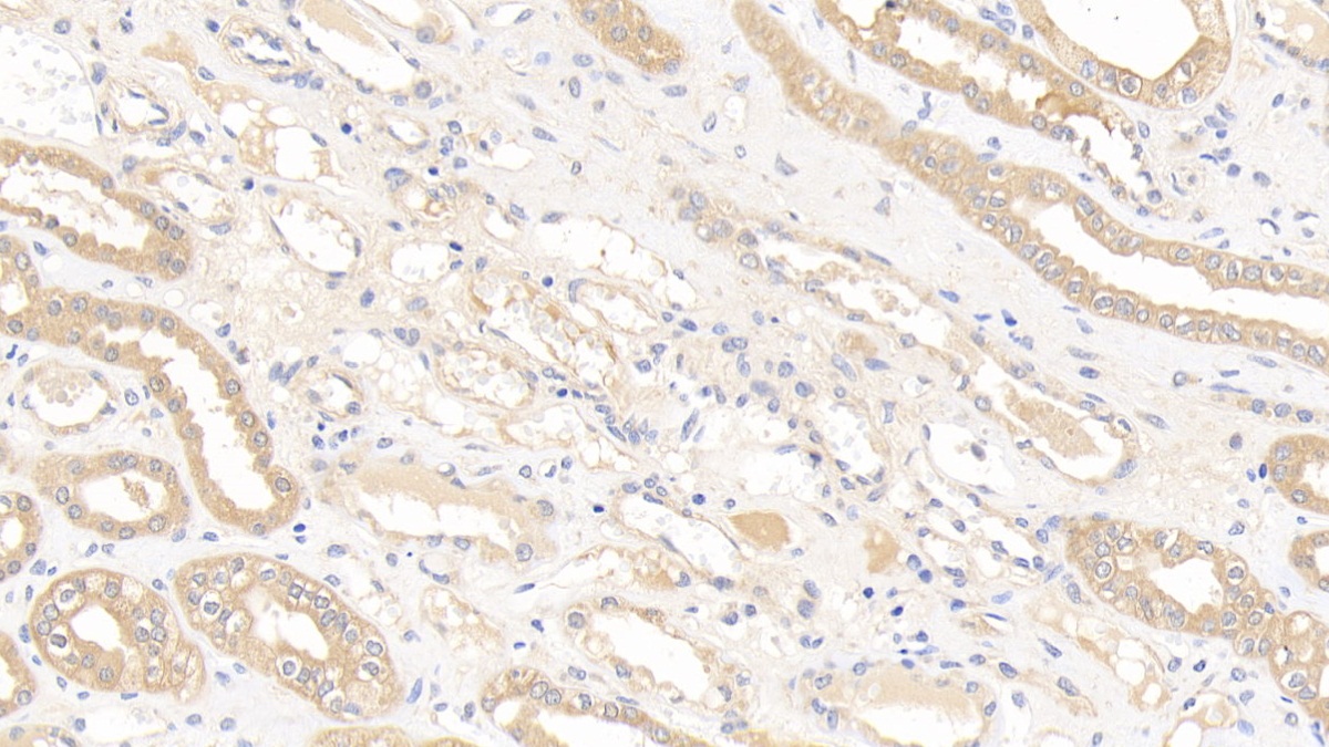 Polyclonal Antibody to Glutathione S Transferase Mu 1 (GSTM1)