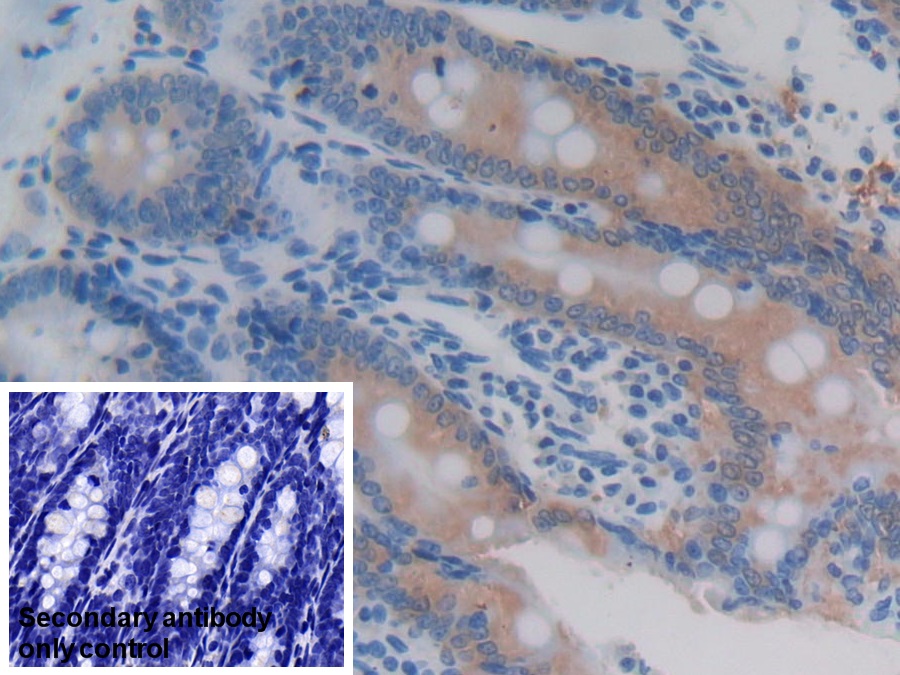 Polyclonal Antibody to Glutathione S Transferase A4 (GSTA4)