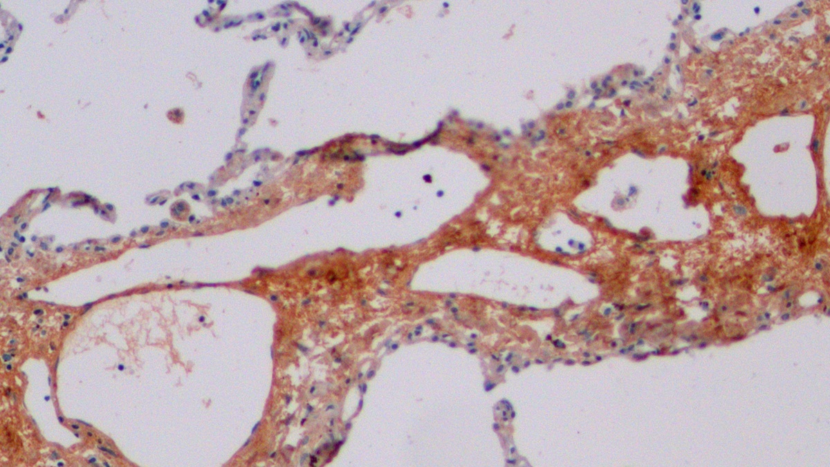 Polyclonal Antibody to Cross Linked C-Telopeptide Of Type I Collagen (CTXI)