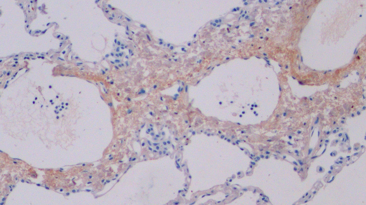 Polyclonal Antibody to Cross Linked C-Telopeptide Of Type I Collagen (CTXI)