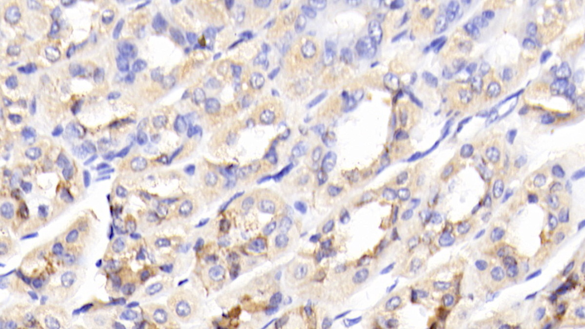 Polyclonal Antibody to Glucokinase (GCK)