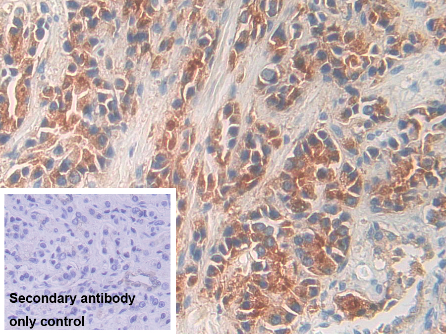 Polyclonal Antibody to Kallikrein 11 (KLK11)