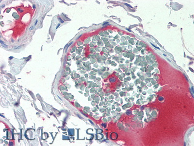 Polyclonal Antibody to Coagulation Factor V (F5)