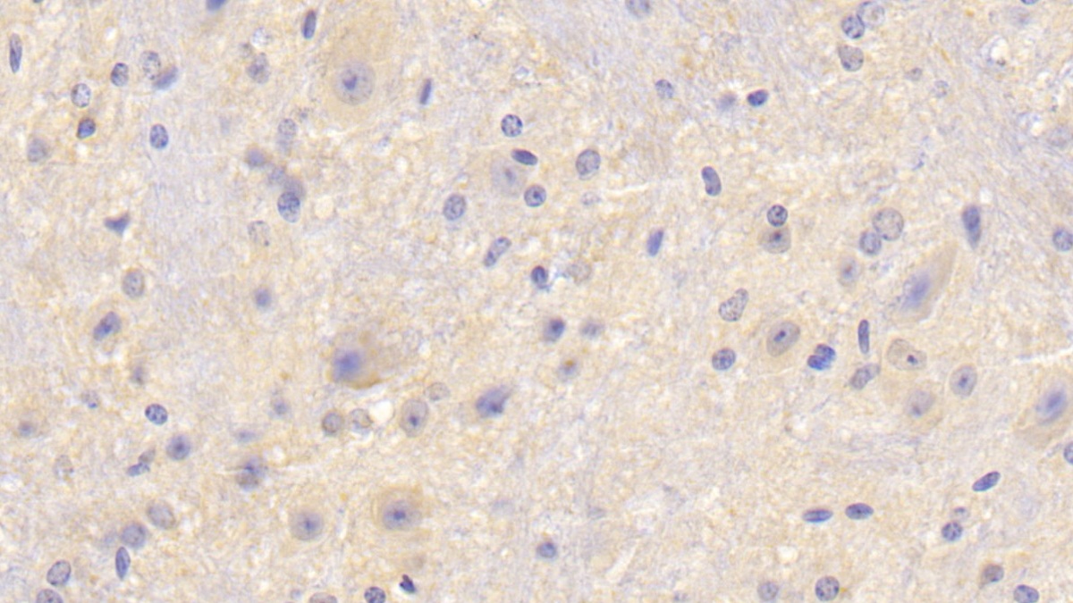 Polyclonal Antibody to Coagulation Factor V (F5)