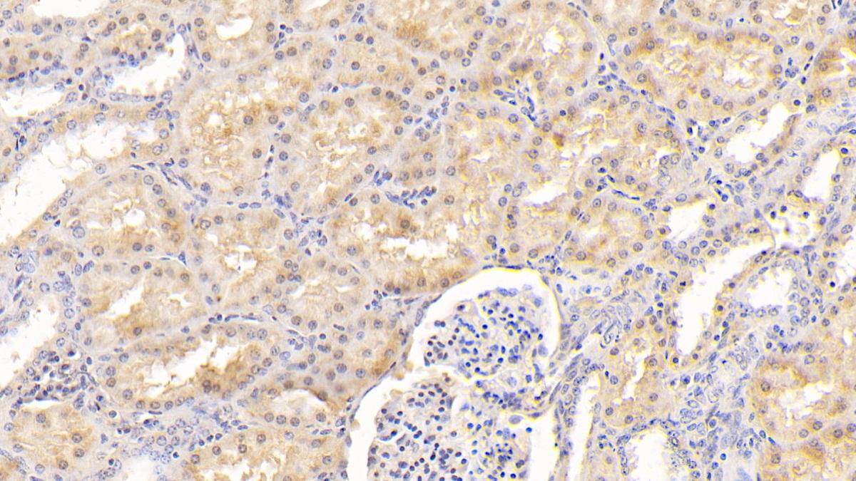 Polyclonal Antibody to Coagulation Factor XII (F12)