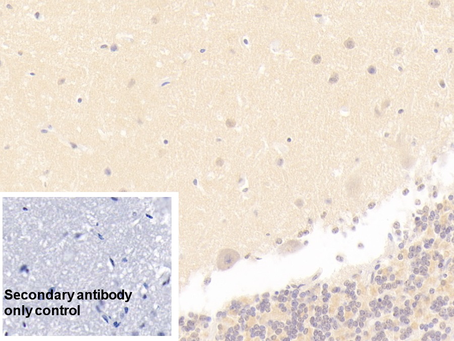 Polyclonal Antibody to Membrane Protein, Palmitoylated 2 (MPP2)