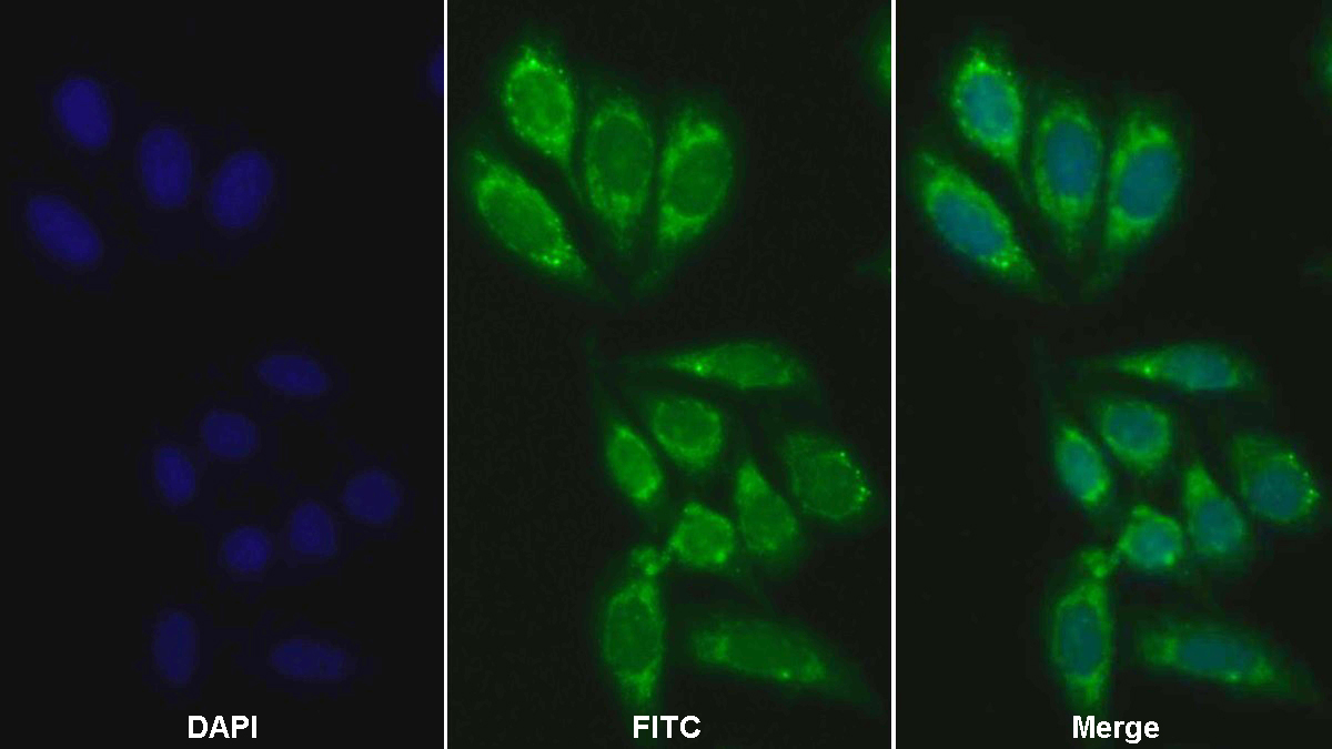 Polyclonal Antibody to Cluster Of Differentiation 14 (CD14)