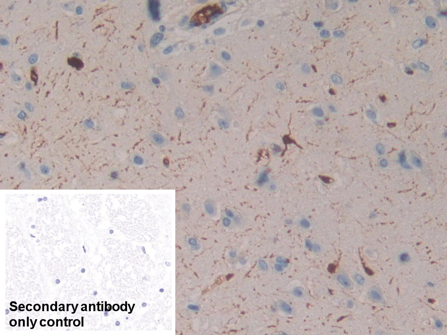 Polyclonal Antibody to Calretinin (CR)