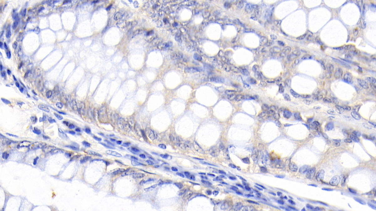 Polyclonal Antibody to Procalcitonin (PCT)