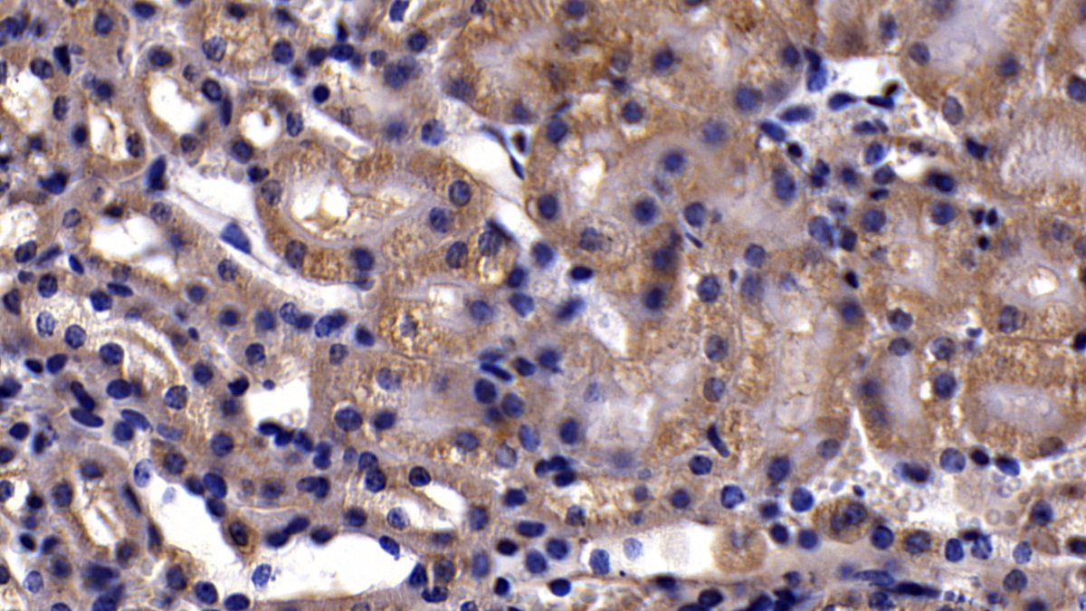 Polyclonal Antibody to Neuropilin 1 (NRP1)