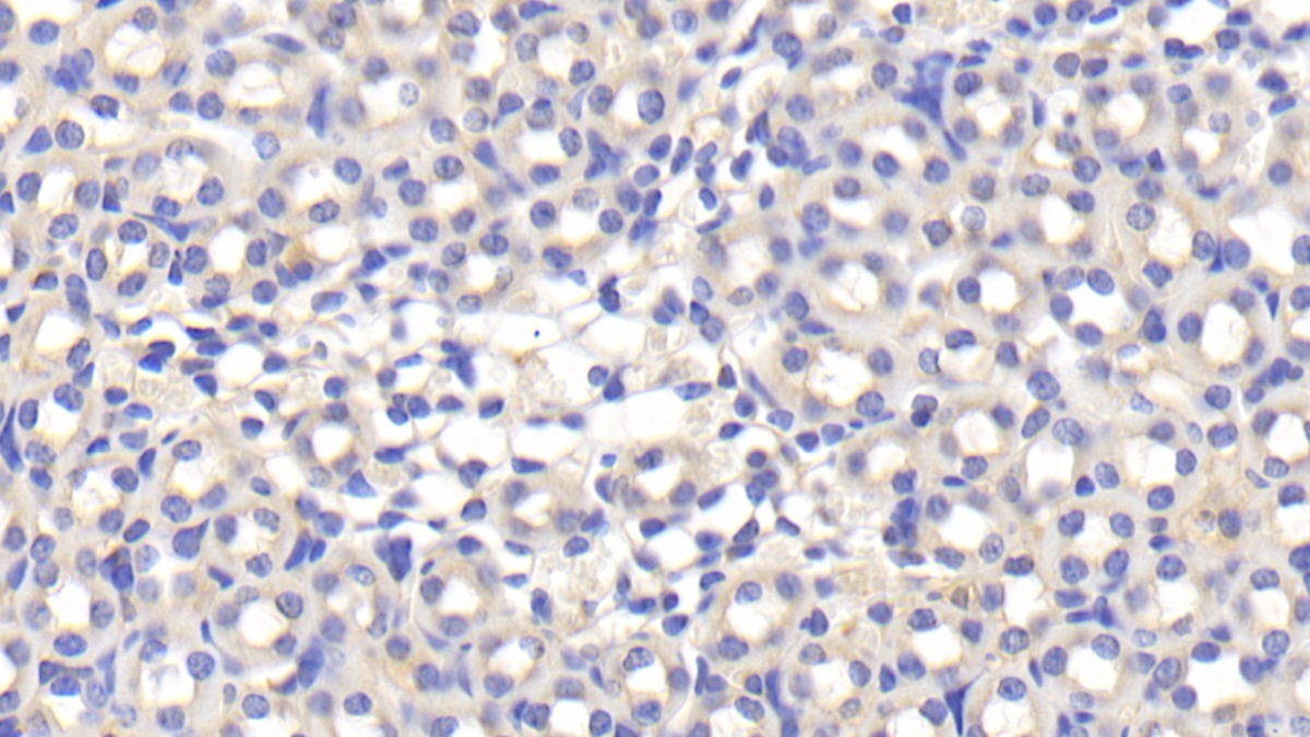 Polyclonal Antibody to Apolipoprotein E (APOE)