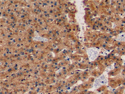 Polyclonal Antibody to Apolipoprotein E (APOE)