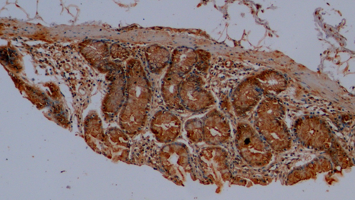 Polyclonal Antibody to Mucin 2 (MUC2)