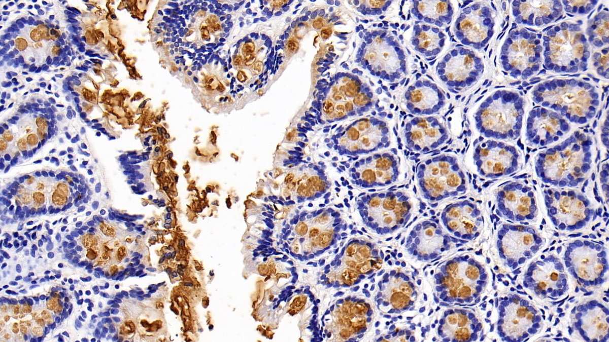 Polyclonal Antibody to Mucin 2 (MUC2)