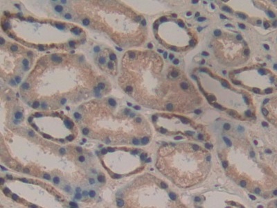 Polyclonal Antibody to Delta-Sleep Inducing Peptide (dSIP)