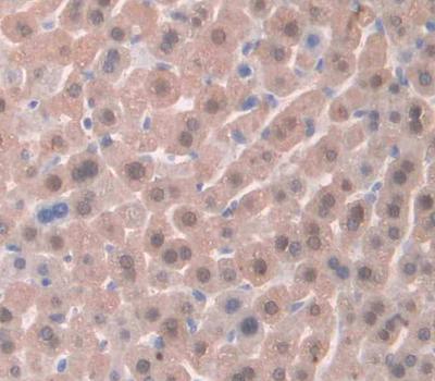 Polyclonal Antibody to Delta-Sleep Inducing Peptide (dSIP)