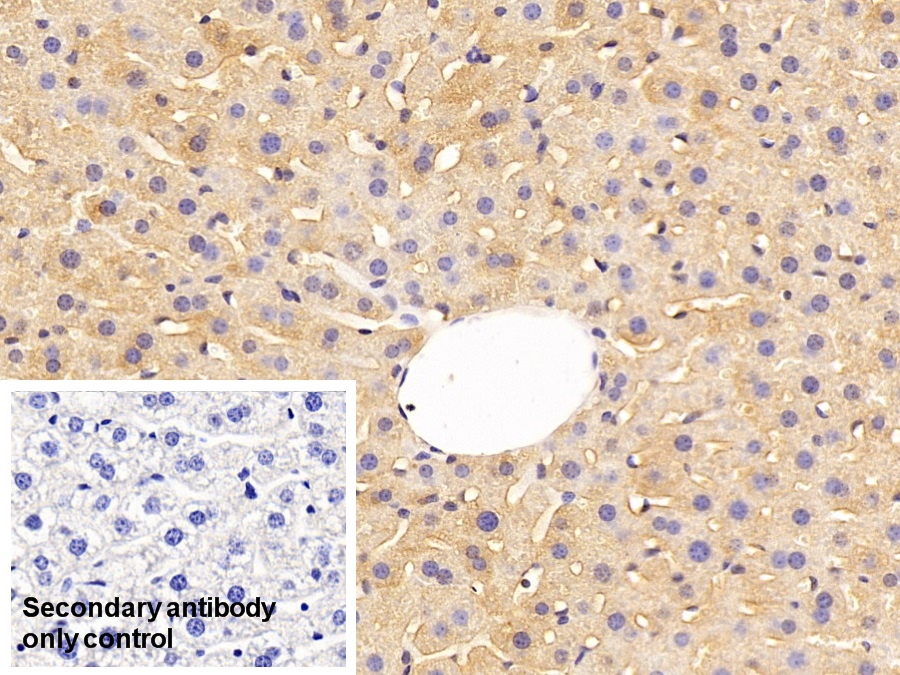 Polyclonal Antibody to Prothrombin Fragment 1+2 (F1+2)