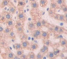 Polyclonal Antibody to Prothrombin Fragment 1+2 (F1+2)