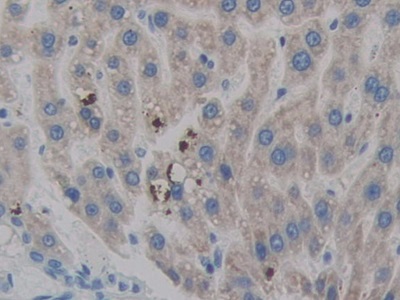 Polyclonal Antibody to Heparanase (HPSE)