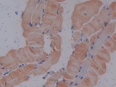 Polyclonal Antibody to Sodium/potassium Transporting ATPase Subunit Beta-3 (ATP1b3)