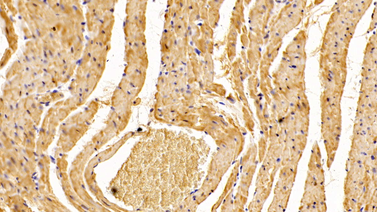 Polyclonal Antibody to ADP Ribosyltransferase 4 (ART4)