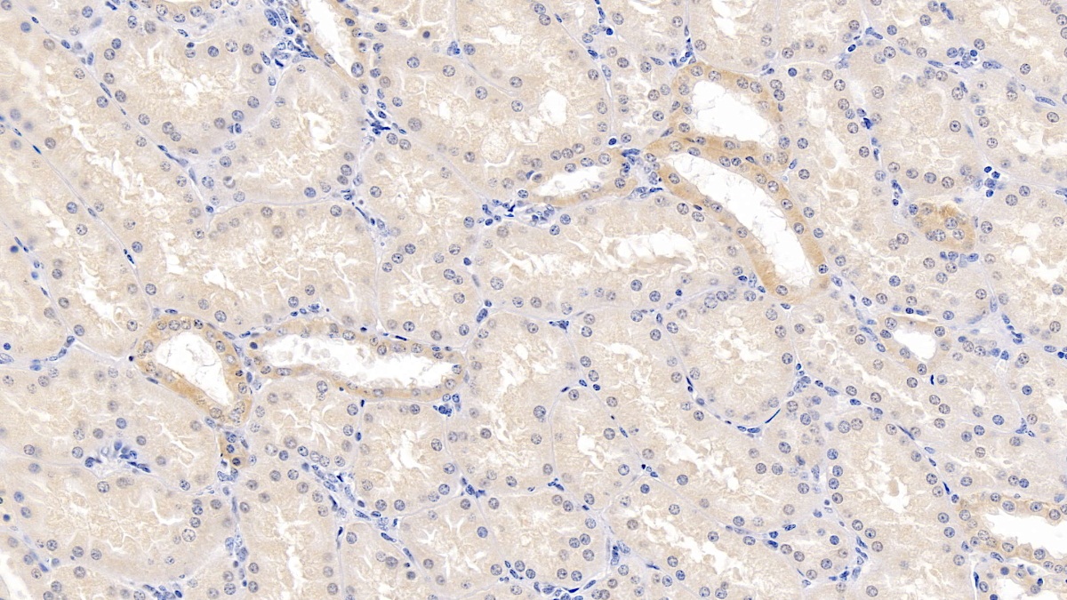 Polyclonal Antibody to G Protein Coupled Receptor 44 (GPR44)