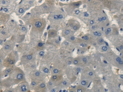 Polyclonal Antibody to C-Type Natriuretic Peptide (CNP)