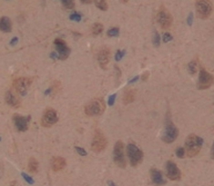 Polyclonal Antibody to C-Type Natriuretic Peptide (CNP)