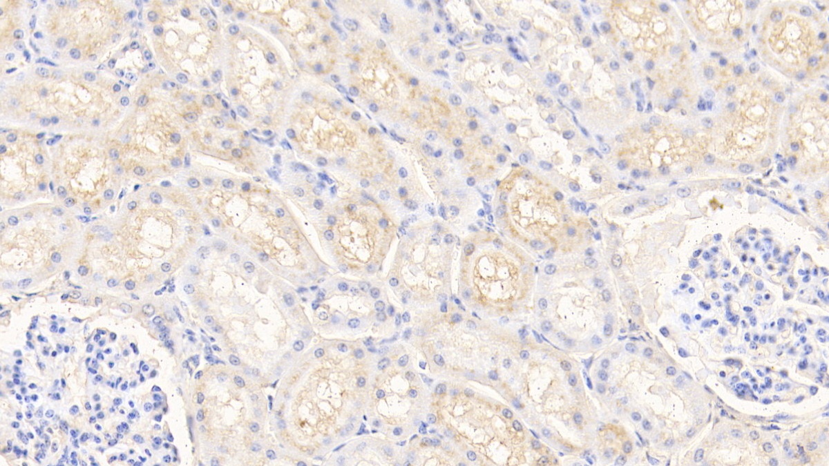 Polyclonal Antibody to Prealbumin (PALB)