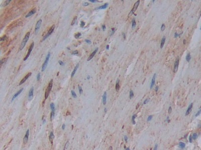 Polyclonal Antibody to Cyclooxygenase 1 (COX-1)