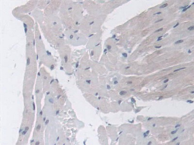 Polyclonal Antibody to Cyclooxygenase 1 (COX-1)