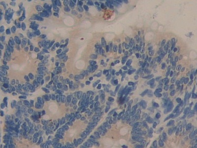 Polyclonal Antibody to Complement Component 7 (C7)